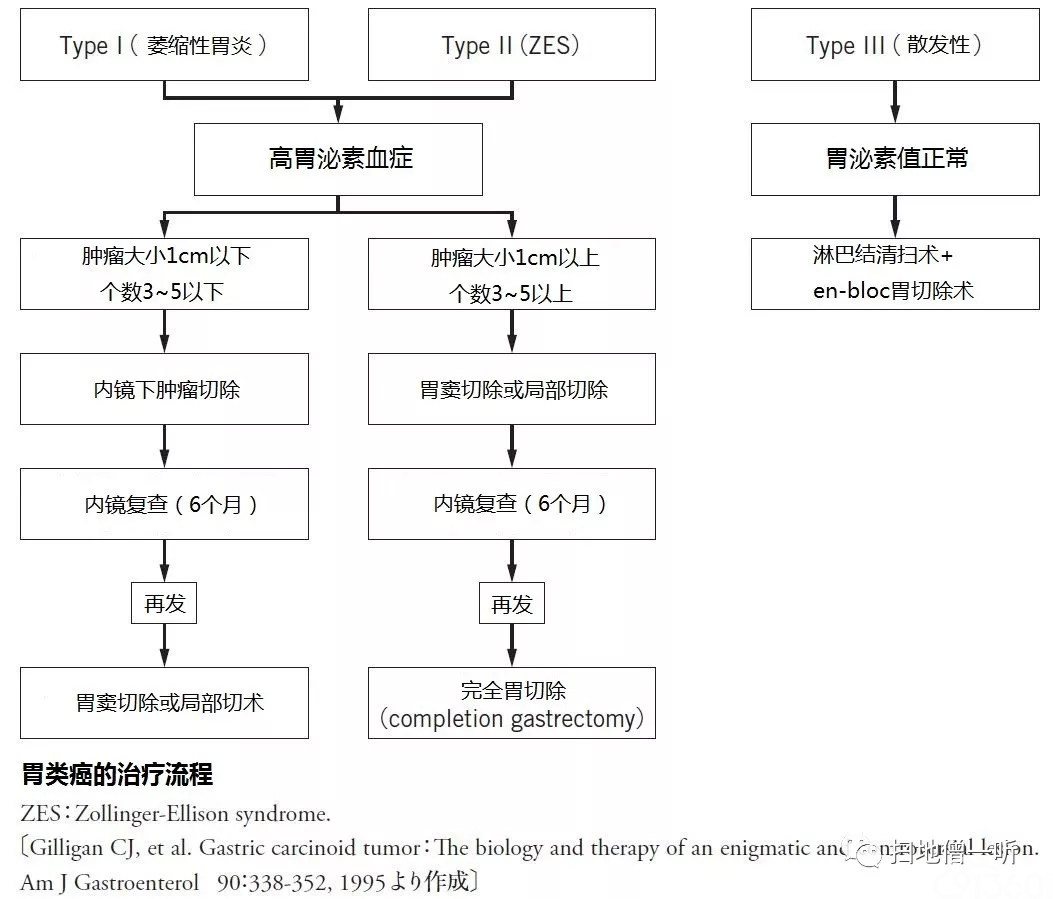 医学美图:胃神经内分泌肿瘤的前世今生