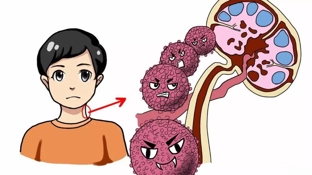 什么是淋巴瘤?