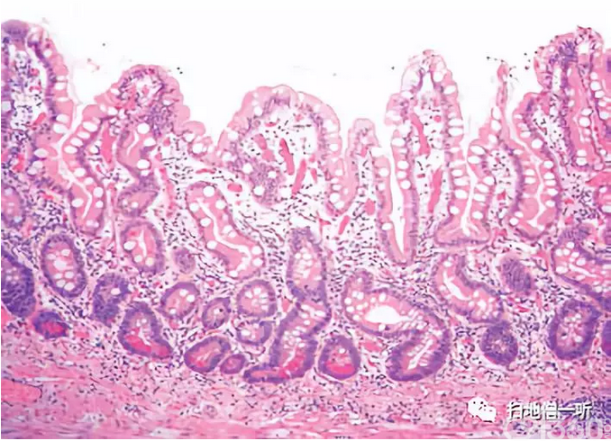 医学美图胃十二指肠上皮性粘膜内病变病理解读