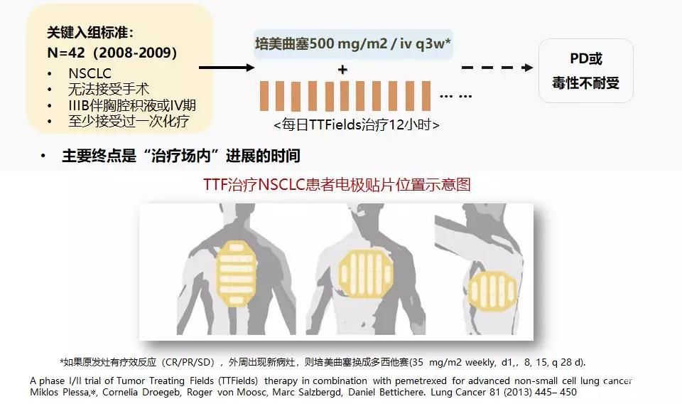 另辟蹊径,看黑科技"肿瘤电场治疗"在胸部肿瘤中的应用前景