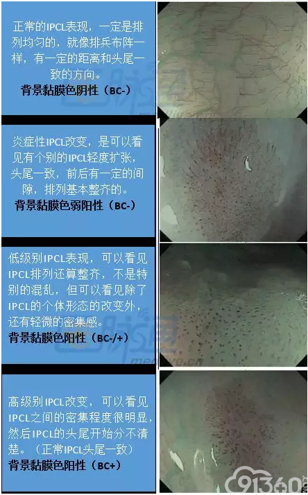 早期食管癌诊断基础