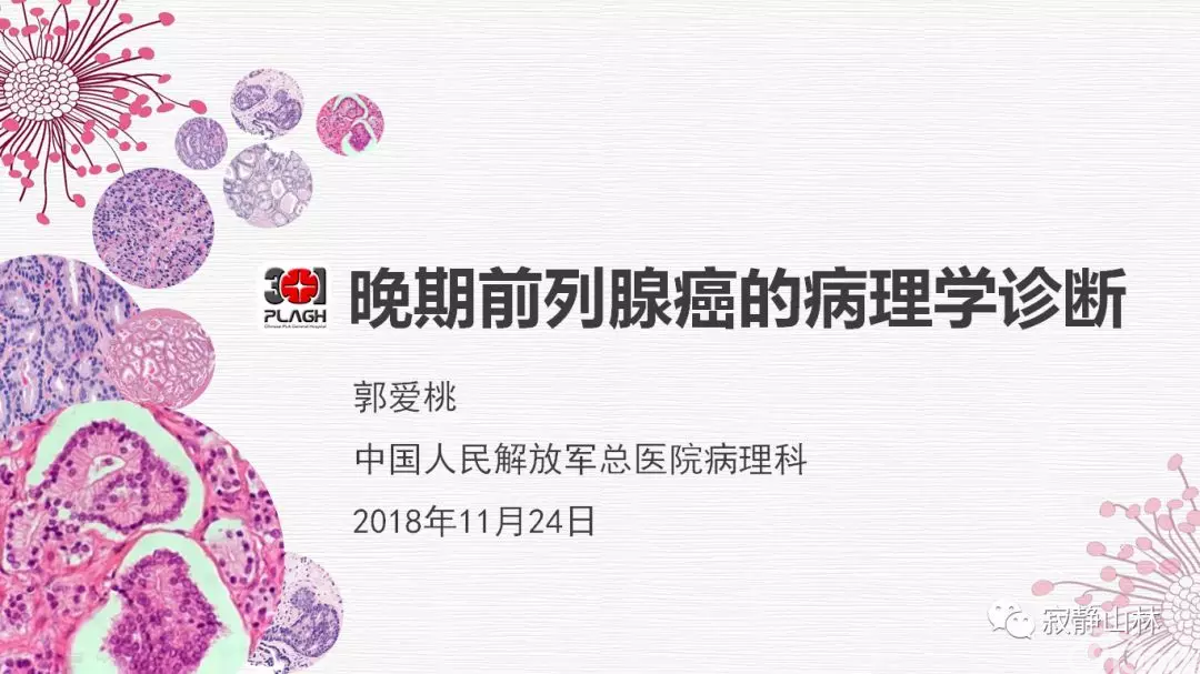 晚期前列腺癌的病理学诊断
