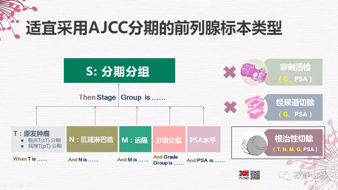 晚期前列腺癌的病理学诊断