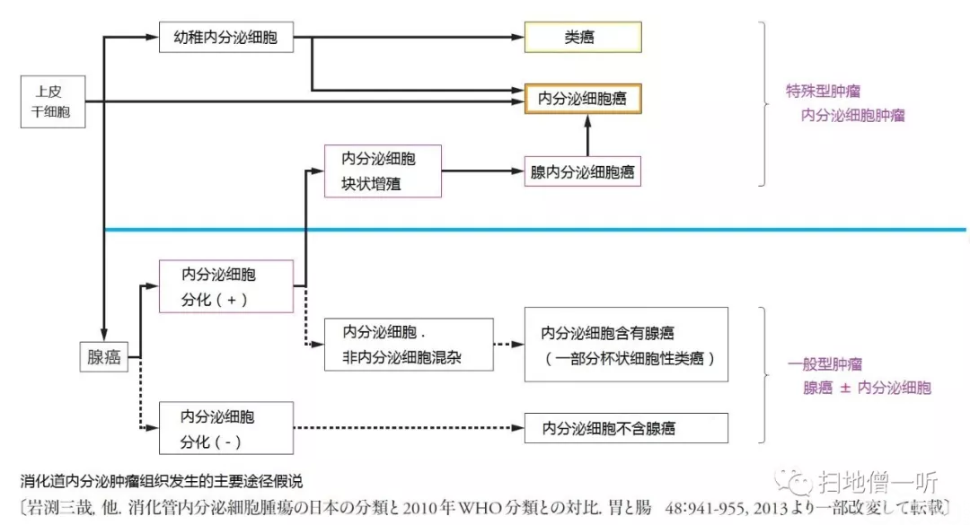 医学美图:胃神经内分泌肿瘤的前世今生