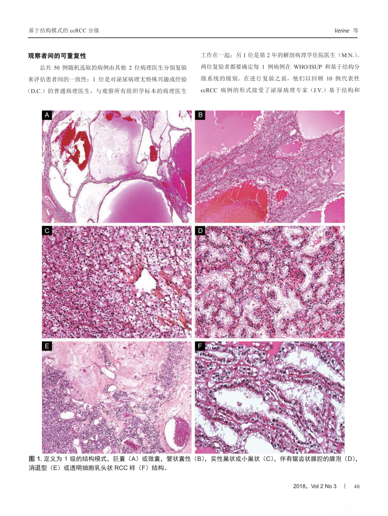 结构模式是透明细胞肾细胞癌预后评估的一种相关形态分级系统