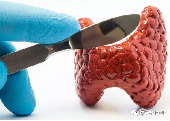 甲状腺癌手术后 病理报告淋巴结有转移咋办