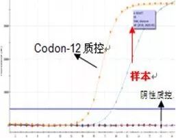 病理是干什么的!“性别”鉴定!