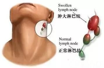 上海发布:大肠癌、肺癌、乳腺癌、肝癌、胃癌、甲状腺癌等14种恶性肿瘤筛查与预防指南