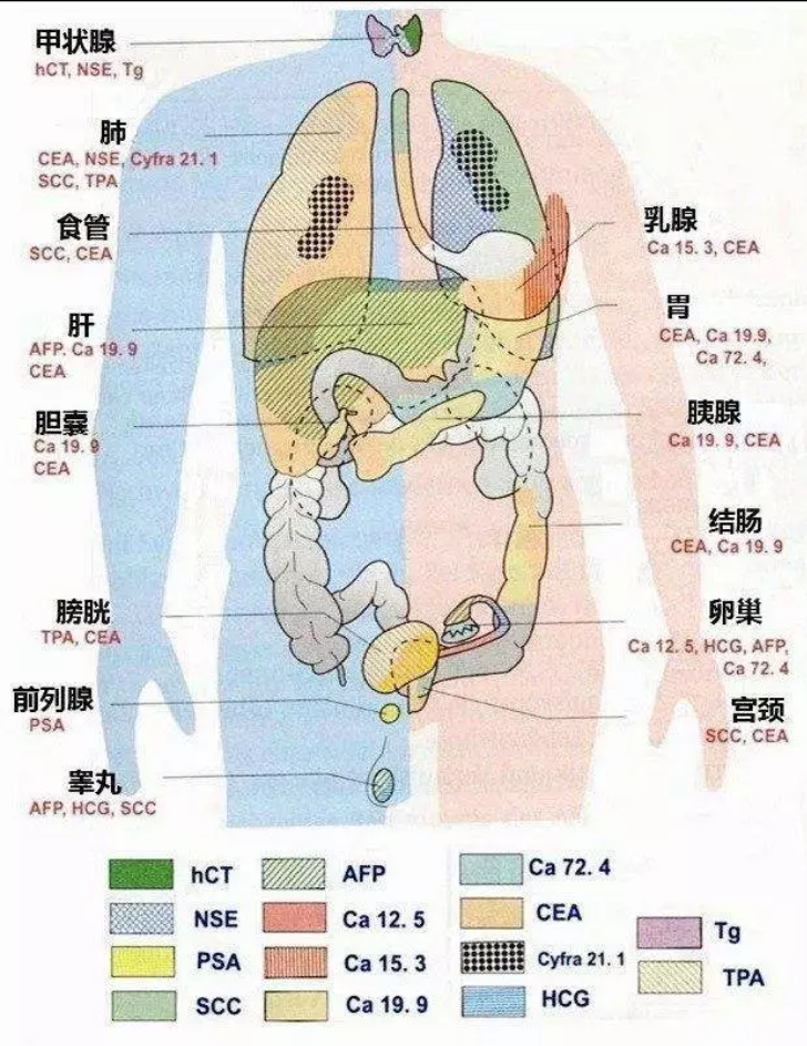 肿瘤标志物,究竟代表什么