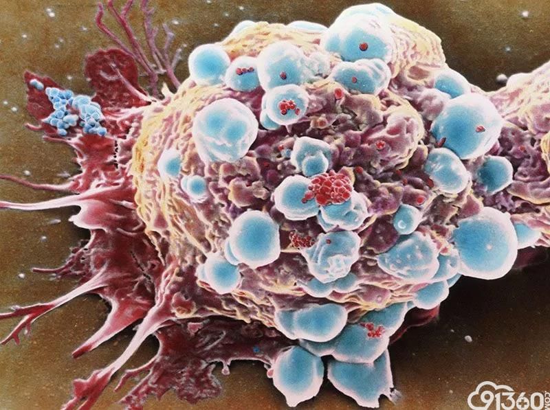 《自然》子刊：突破！科学家首次在多癌种中证实TMB可预测免疫治疗效果 高TMB总生存率更高 但TMB的取值与癌种有关丨临床大发现