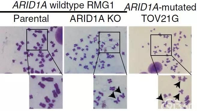 揭示ARID1A基因的悖论——使基因组不稳定来抑制肿瘤